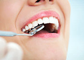 Top 5 Cosmetic Dentistry Frequently Asked Questions