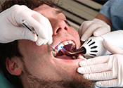 Why you should consider implant dentistry for missing teeth.