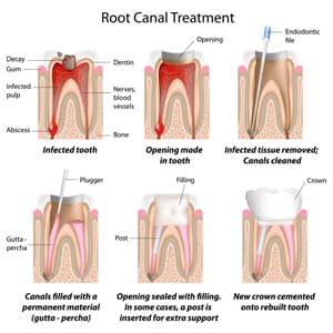 Achieving the best of cosmetic dentistry.