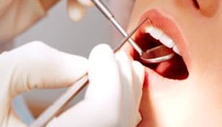 WHAT YOU NEED TO KNOW ABOUT ROOT CANAL TREATMENT