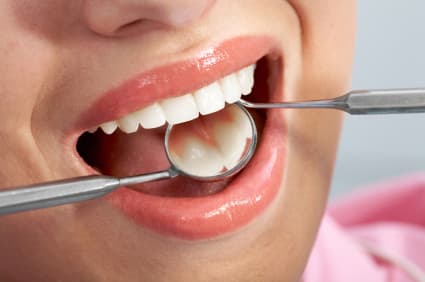 What Are the Benefits of Tooth Implants in Murfreesboro, TN?