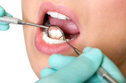 How to Maintain Your Dental Implants in Murfreesboro?