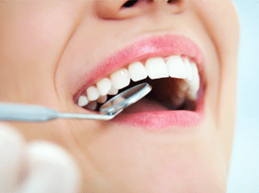 When to have Dental Crowns? Murfreesboro, TN
